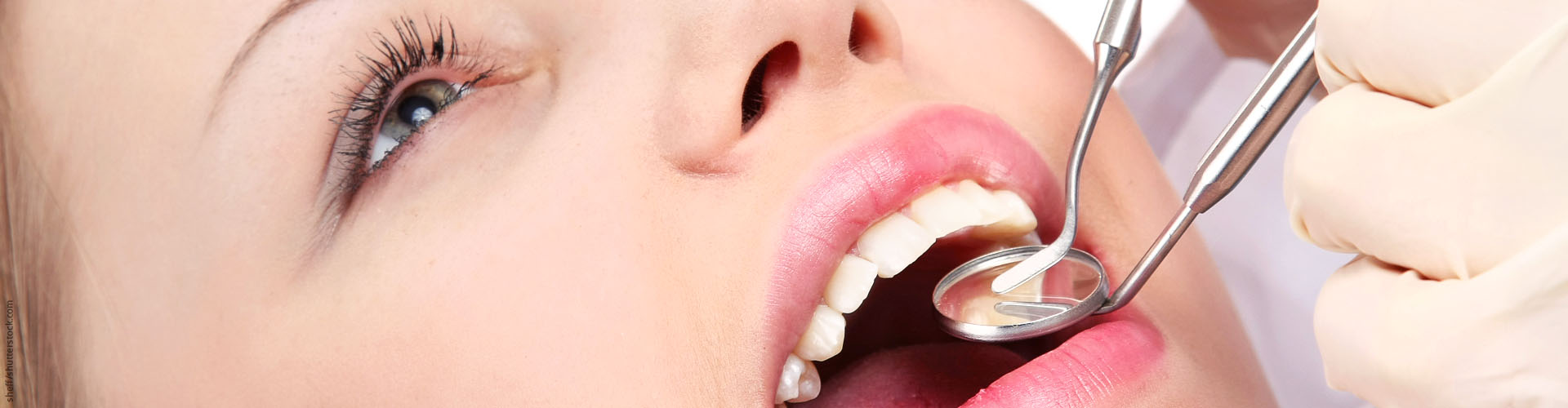 KFO-Prophylaxe in Bergisch Gladbach