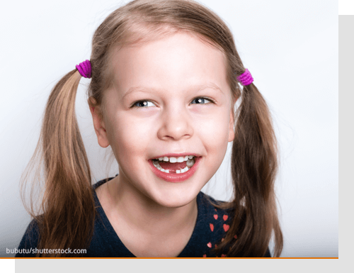 Ab wann eine kieferorthop�dische Behandlung sinnvoll ist