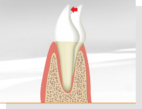 Kieferorthop�die bedeutet Zahnfehlstellungen beheben
